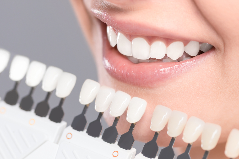 Cosmetic Dentistry in Carlsbad